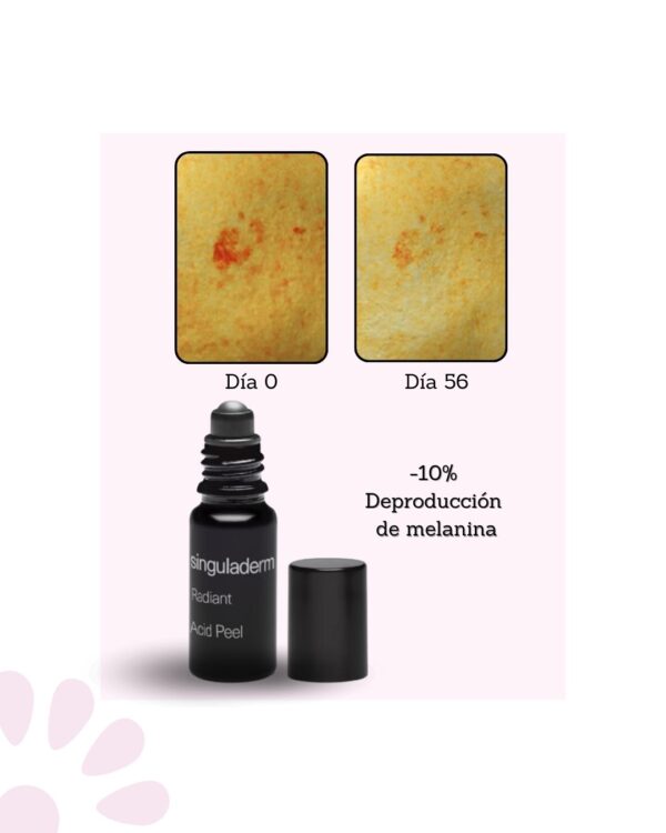 Singuladerm Radiant Acid Peel 10ml - Imagen 2